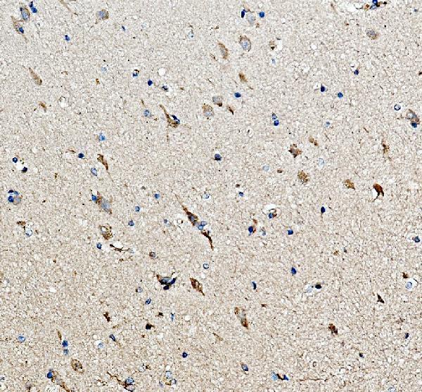 a02841 2 mc3r primary antibodies ihc testing 1
