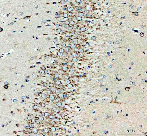 a02841 2 mc3r primary antibodies ihc testing 3