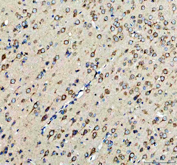 a02841 2 mc3r primary antibodies ihc testing 4