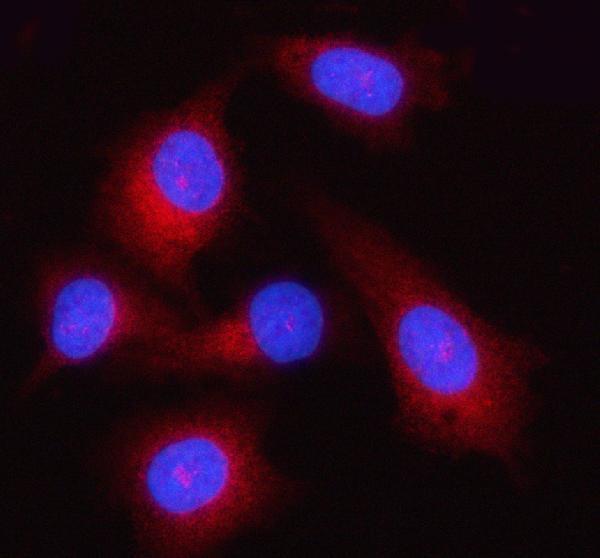 a02842 gsdmd primary antibodies if testing 3