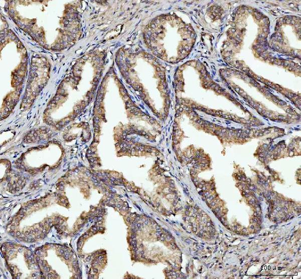  IHC analysis of GSDMD using anti-GSDMD antibody (A02842)