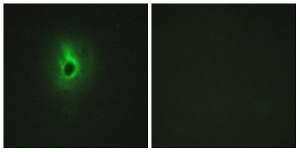 Immunofluorescence analysis of HeLa cells, using Collagen VI alpha3 Antibody