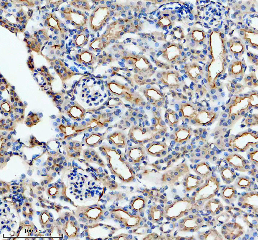 IHC analysis of PSMA/GCPII/FOLH1 using anti-PSMA/GCPII/FOLH1 antibody (A02846-2)