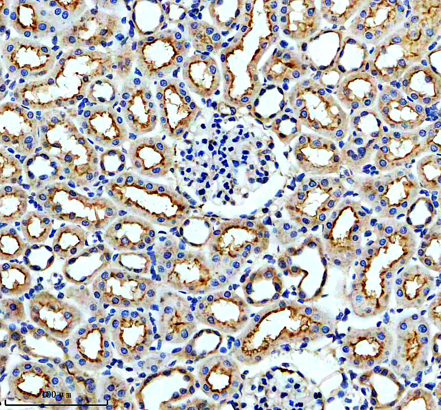 IHC analysis of PSMA/GCPII/FOLH1 using anti-PSMA/GCPII/FOLH1 antibody (A02846-2)