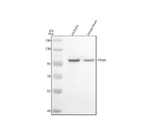 Western blot analysis of PSMA/GCPII/FOLH1 using anti-PSMA/GCPII/FOLH1 antibody (A02846-2)