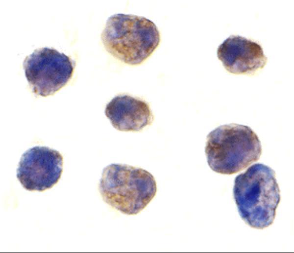 Immunocytochemistry of TAB1 in K562 cells with TAB1 antibody at 1 μg/mL