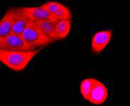 ICC staining K63-linkage Specific Ubiquitin in Hela cells (red)