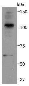 Western blot analysis of K63-linkage Specific Ubiquitin on Hela cells lysates using anti-K63-linkage Specific Ubiquitin antibody at 1/1,000 dilution