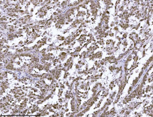  IHC analysis of JHDM3A/JMJD2A/KDM4A using anti-JHDM3A/JMJD2A/KDM4A antibody (A02850-1)