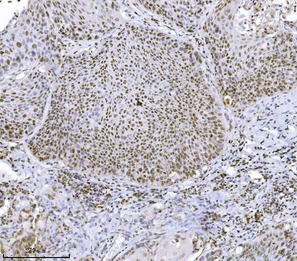  IHC analysis of JHDM3A/JMJD2A/KDM4A using anti-JHDM3A/JMJD2A/KDM4A antibody (A02850-1)