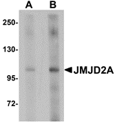Western blot analysis of JMJD2A in rat liver tissue lysate with JMJD2A antibody at (A) 1 and (B) 2 μg/mL