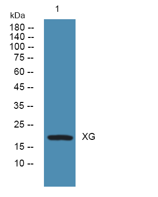 Western blot analysis of lysates from KB cells, primary antibody was diluted at 1:1000, 4°over night