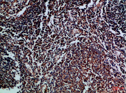 Immunohistochemical analysis of paraffin-embedded Human-tonsil, antibody was diluted at 1:100