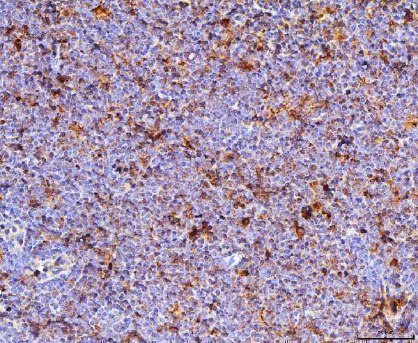  IHC analysis of Cd70 using anti-Cd70 antibody (A02853-2)