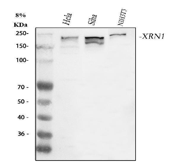  Western blot analysis of XRN1 using anti-XRN1 antibody (A02855-2)