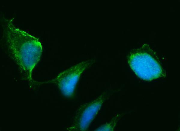 a02856 2 hsd3b1 primary antibodies if testing 4