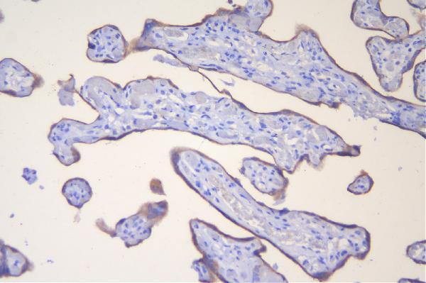 a02856 2 hsd3b1 primary antibodies ihc testing 2_1