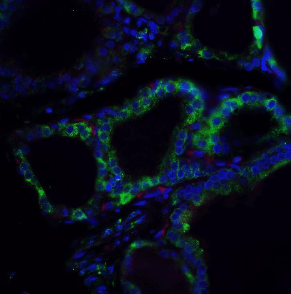 a02857 1 rspo1 primary antibodies if testing 5