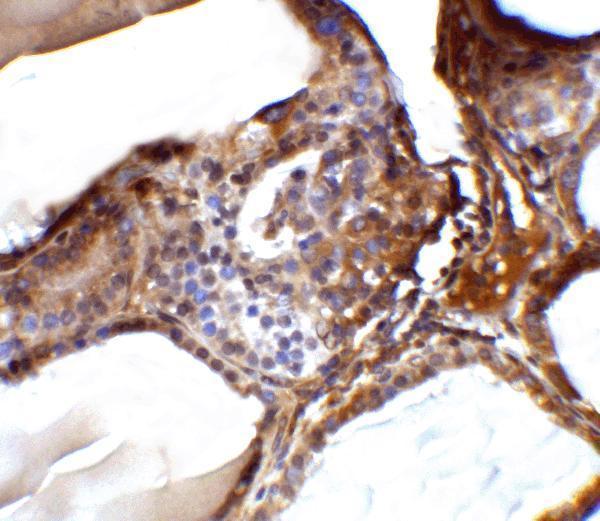 a02857 1 rspo1 primary antibodies ihc testing 7