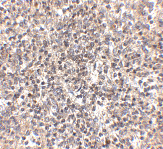 a02857 1 rspo1 primary antibodies ihc testing 8
