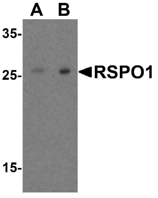 a02857 1 rspo1 primary antibodies wb testing 4