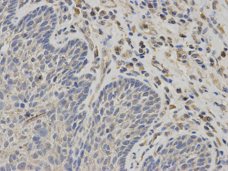 a02858 nr1i3 primary antiboties if testing 2