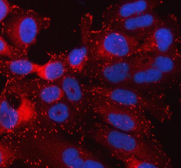 a02859 2 tln1 primary antibodies if testing 2