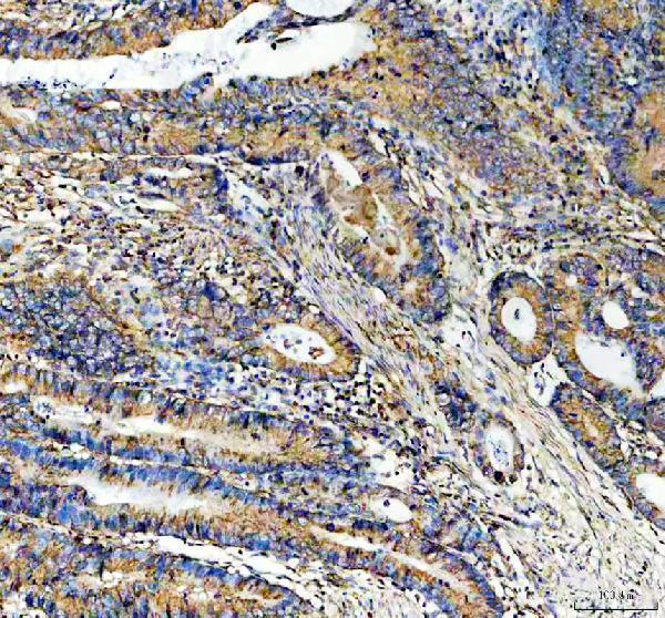 a02859 2 tln1 primary antibodies ihc testing 1