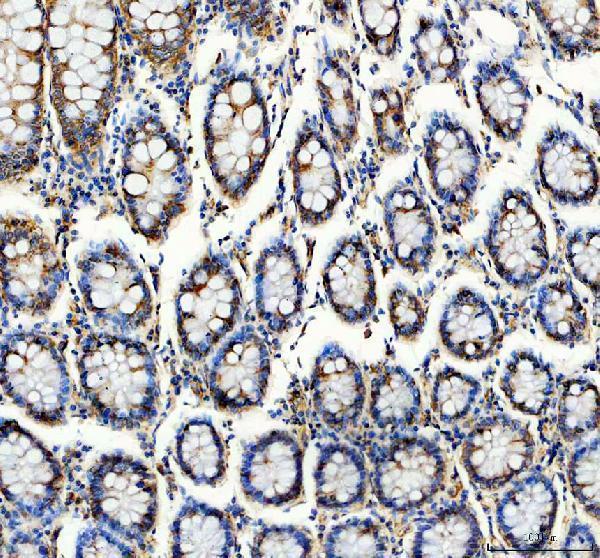 a02859 2 tln1 primary antibodies ihc testing 2