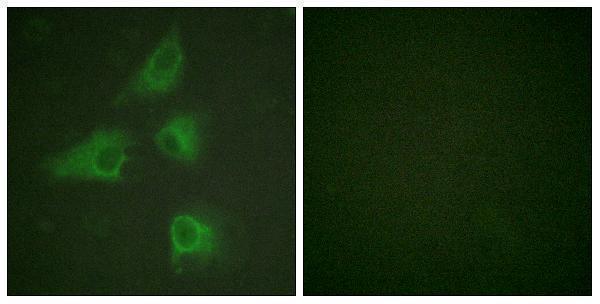 a02860 1 dpysl2 primary antibodies if testing 1