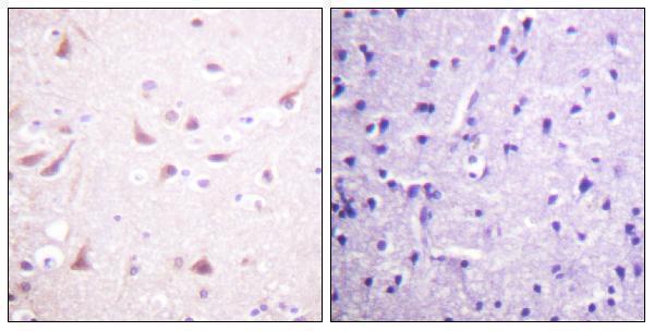 a02860 1 dpysl2 primary antibodies ihc testing 5