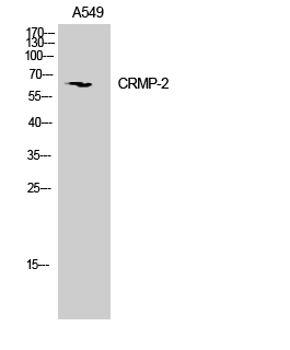 a02860 1 dpysl2 primary antibodies wb testing 2