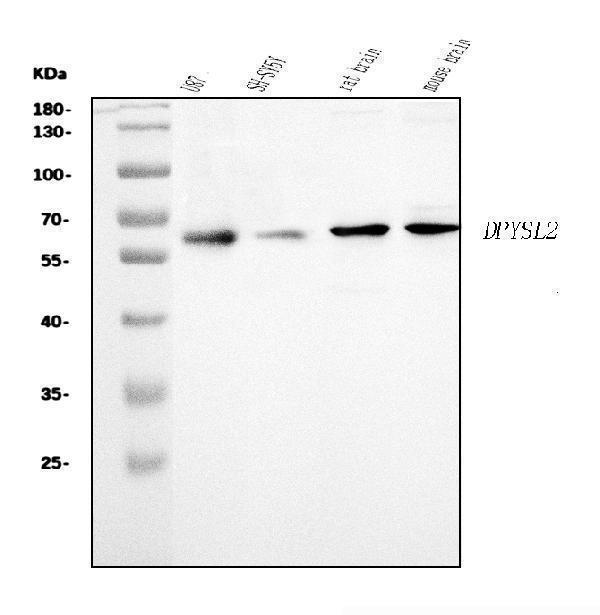  Western blot analysis of CRMP2/DPYSL2 using anti-CRMP2/DPYSL2 antibody (A02860-4)