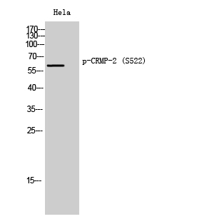 Western Blot analysis of Hela cells using Phospho-CRMP-2 (S522) Polyclonal Antibody diluted at 1:2000