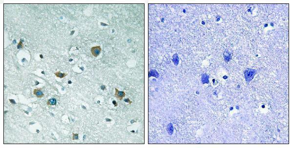 a02860t509 dpysl2 primary antibodies ihc testing 1