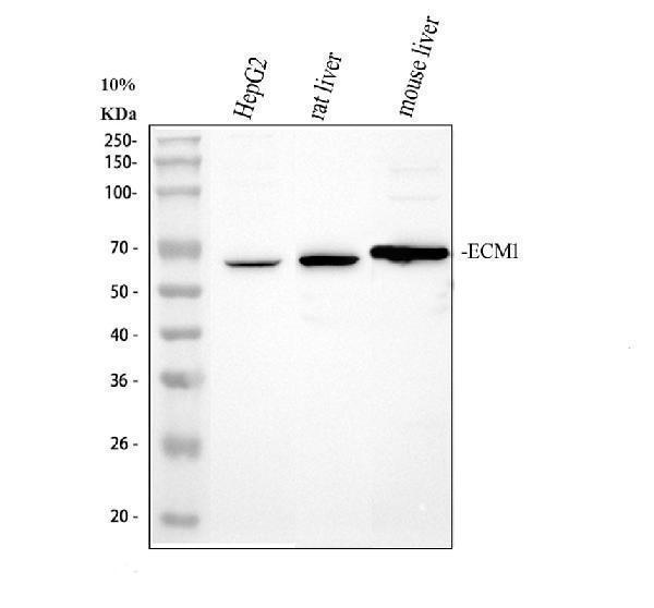 Western blot analysis of ECM1 using anti-ECM1 antibody (A02861-2)