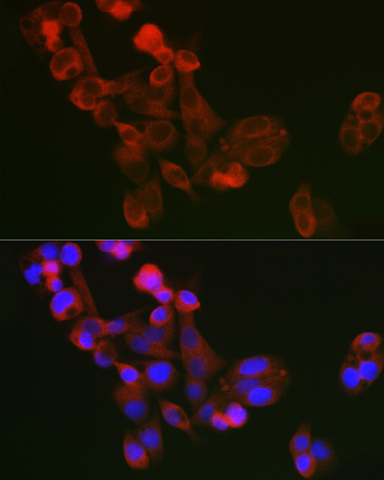 Immunofluorescence analysis of A375 cells using ECM1 Rabbit pAb  at dilution of 1:100 
