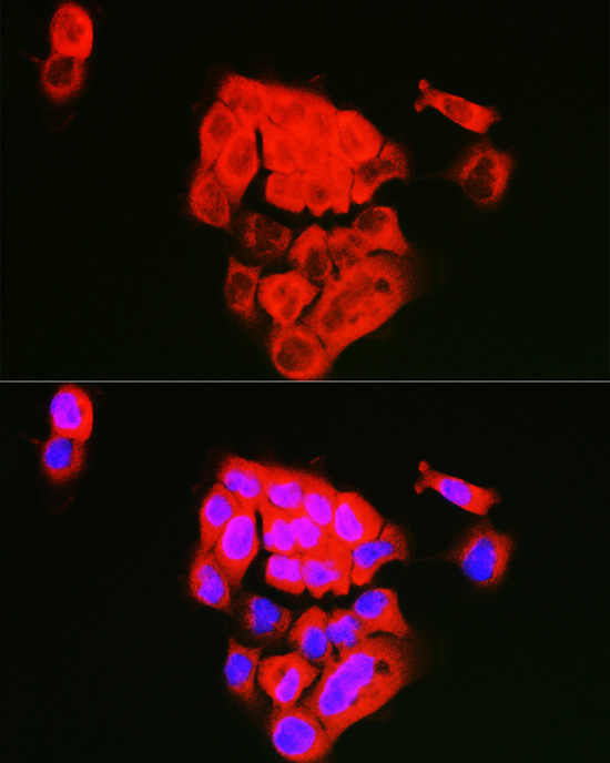 Immunofluorescence analysis of A431 cells using ECM1 Rabbit pAb  at dilution of 1:100 