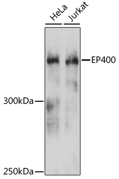 a02863 ep400 primary antiboties wb testing 1