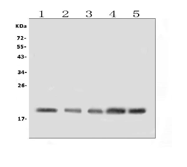 Western blot analysis of BAFF Receptor using anti-BAFF Receptor antibody (A02865-1). Electrophoresis was performed on a 5-20% SDS-PAGE gel at 70V (Stacking gel) / 90V (Resolving gel) for 2-3 hours. The sample well of each lane was loaded with 50ug of sample under reducing conditions. Lane 1: human Jurkat whole cell lysates, Lane 2: rat spleen tissue lysates, Lane 3: rat thymus tissue lysates, Lane 4: mouse spleen tissue lysates, Lane 5: mouse thymus tissue lysates. After Electrophoresis, proteins were transferred to a Nitrocellulose membrane at 150mA for 50-90 minutes. Blocked the membrane with 5% Non-fat Milk/ TBS for 1.5 hour at RT. The membrane was incubated with rabbit anti-BAFF Receptor antigen affinity purified polyclonal antibody (Catalog # A02865-1) at 0.5 μg/mL overnight at 4°C, then washed with TBS-0.1%Tween 3 times with 5 minutes each and probed with a goat anti-rabbit IgG-HRP secondary antibody at a dilution of 1:10000 for 1.5 hour at RT. The signal is developed using an Enhanced Chemiluminescent detection (ECL) kit (Catalog # EK1002) with Tanon 5200 system. A specific band was detected for BAFF Receptor at approximately 19KD. The expected band size for BAFF Receptor is at 19KD.