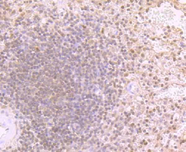 Immunohistochemical analysis of paraffin-embedded human spleen tissue using anti-Proteasome 20S LMP2 antibody