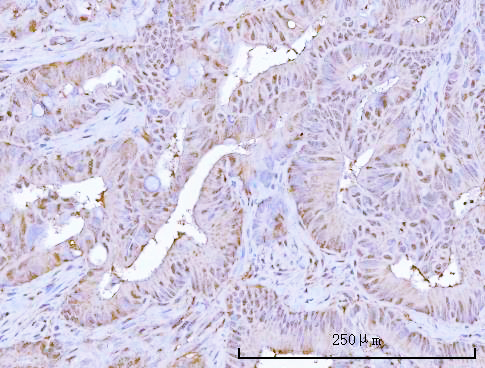  IHC analysis of PSMB9 using anti-PSMB9 antibody (A02867-2)