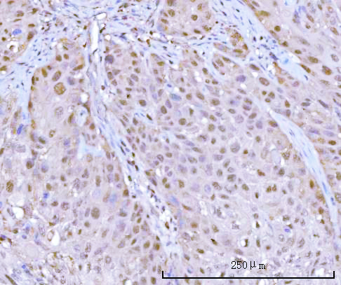  IHC analysis of PSMB9 using anti-PSMB9 antibody (A02867-2)