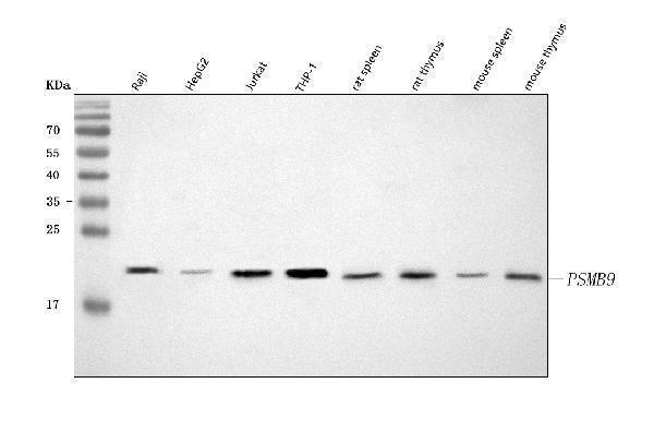  Western blot analysis of PSMB9 using anti-PSMB9 antibody (A02867-2)