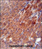 a02868 1 anti ces2 antibody center ihc p testing 4