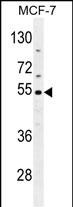 CES2 Antibody (Center) western blot analysis in MCF-7 cell line lysates (35ug/lane)