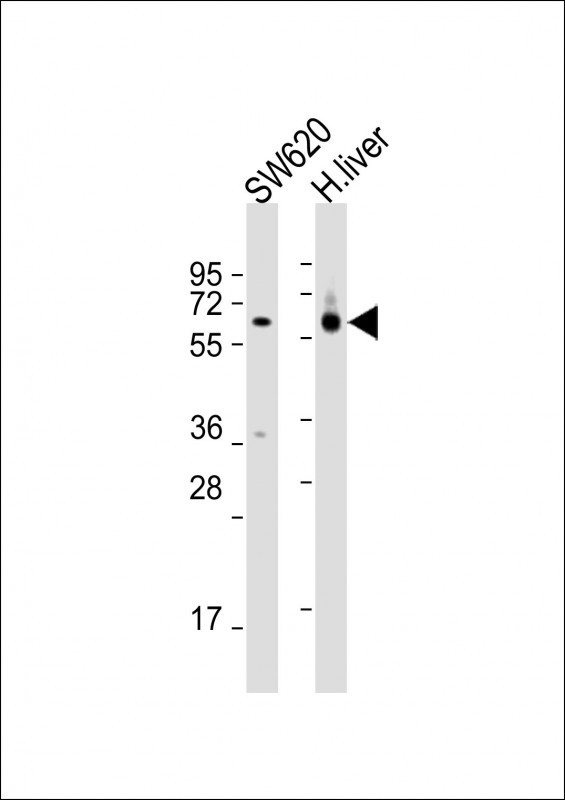 All lanes : Anti-CES2 Antibody (Center) at 1:2000 dilutionLane 1: SW620 whole cell lysatesLane 2: human liver lysatesLysates/proteins at 20 µg per lane
