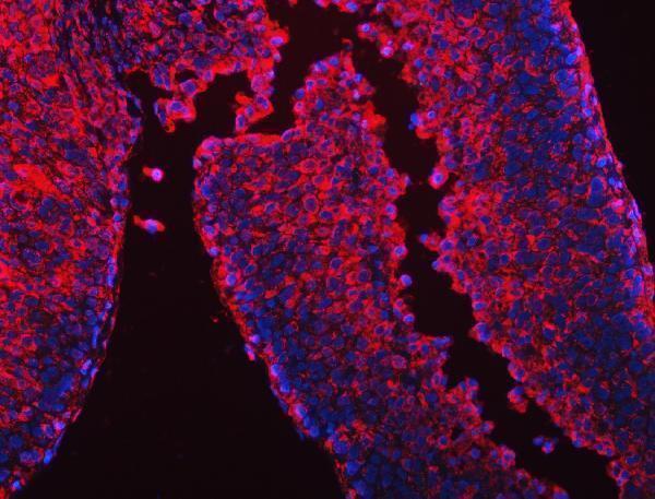 IF analysis of CES2 using anti-CES2 antibody (A02868-2)