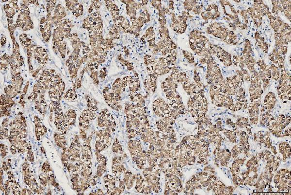 IHC analysis of CES2 using anti-CES2 antibody (A02868-2)