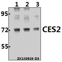 Western blot (WB) analysis of CES2 (Q369) pAb at 1:500 dilution
Lane1:HepG2 whole cell lysate(40ug)
Lane2:HCT116 whole cell lysate(40ug)
Lane3:AML-12 whole cell lysate(40ug)